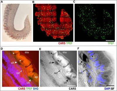 Imaging Arm Regeneration: Label-Free Multiphoton Microscopy to Dissect the Process in Octopus vulgaris